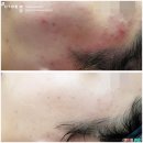 더 예쁨뷰티 이미지