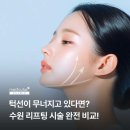 메디큐브의원 | 수원 리프팅 시술 총정리 비교해보기 (수원메디큐브)