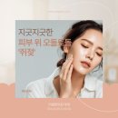 부천 쥐젖 제거 잘하는 피부관리 한의원 무제한 제거 후기