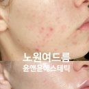 노원역 5번출구 이미지