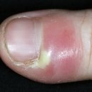 NO.1 자동차피부과 이미지