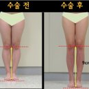 후메디앙스 이미지