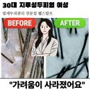 [공지] 지루성피부염 두피열 고민, 두피샵 케어 후기