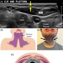 Neck regional anatomy classifications 이미지