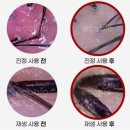 디에스투