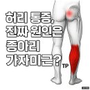 허리통증, 진짜 원인은 종아리 가자미근? 이미지
