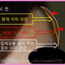 이마