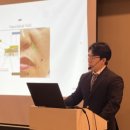 박영진 | 기미잡티 레이저 비용? 후기? 그것만 믿으면 색소침착 생깁니다