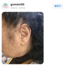 대동 독일보청기 이미지