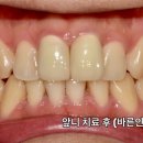 인성치과기공소 이미지