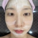이삭토스트 영등포구청점 | 영등포 피부관리추천 : 연예인만들기에서 관리받은 후기