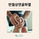 광혜병원 | [광혜병원 스포츠의학센터] 반월상연골파열