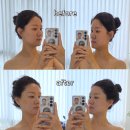 폴리프라자한대점 | 넓어진 모공과 블랙헤드가 고민이라면, 안성아양동피부관리 아이네에스테틱