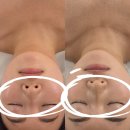 더힐테라피 | 대전 봉명동피부관리｜소통 휠로스테라피 브레인테라피 헤드힐 서클 관리 후기