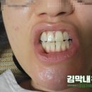 완주군 보건소 | 완주군보건소 임산부 치주관리 프로그램 참여
