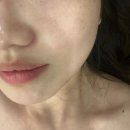 에바다뷰티 | 관악구에스테틱 에바다뷰티 수분보충관리 후기