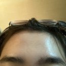 김종민피부과의원 | 나의 피부 고군분투 일지 with 비누, 야즈, 피부과