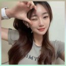 휜코교정 후기, 가격, 회복기간까지 총정리