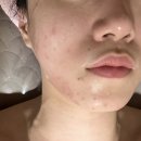 씨유 수내푸른마을점 | 수내 피부관리 &lt;올가뷰티 성남푸른마을수내점&gt; 후기