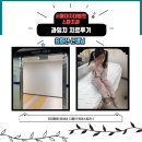 옥광약국 | 서울대치대병원 소아치과 과잉치치료후기 수술경과기록 (최희선 선생님)