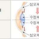 안경크리닉 이미지