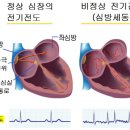 심장 안팎서 부정맥 유발부위 치료···효과 월등 이미지