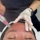 파발로 | 경기광주피부관리 에스테틱 추천 이프유스킨 에스테인 페이스핏톡스 리프팅 후기