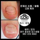 킴스케어시스템