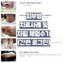 아이샵(i#) | 여자 전두탈모 원인과 예방 - 초기 증상 완화 방법