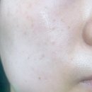 뽑기박스 이미지