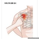 망포중학교 | [영통도수치료] 어깨, 무릎 통증 재활_Time to REHAB 재활운동센터