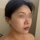 블리스 에스테틱 | 성동구 금호동피부관리 속건조 관리 물톡스 후기 블리스에스테틱