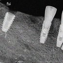 동탄가온치과의원 이미지