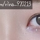 현동명에디성형외과의원 이미지