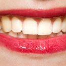 줌바피트니스댄스 (A) 이미지