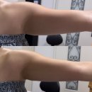 대흥빌딩 | 김해 삼계동 키아뷰티 / 팔관리 팔뚝살 가을 겨울 다이어트 관리 예신관리로 추천