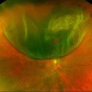 바른안과 이미지