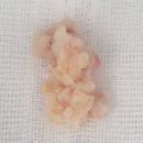 연세하나영상의학과의원 | 전립선비대증수술후기, 빠르게 회복하신 71세 환자 사례