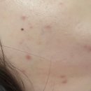 [ 천안 성정동 에스테틱 ] 피부, 두피관리, 다이어트 전문 빛나는나 천안성정점 후기