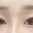 눈치코치 위드렌즈 김해 장유점 이미지