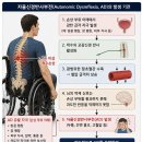 약물 없이 경기력 높이는 위험한 도핑자율신경반사부전과 부스팅(Autonomic Dysreflexia and Boosting) 이미지