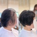세븐일레븐 김포감정2호점 | 소중한 마음을 담은 선물, 일산 항암가발 후기