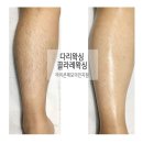 끌라레왁싱