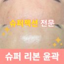 평거슈퍼 | [공지] 진주슈퍼젝션, 아무에게나 받으면 안 됩니다. 차크란 에스테틱의 <슈퍼 리본 윤곽>