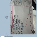 밝은누리안과병원 | 대전 렌즈삽입수술 “밝은누리안과” 검안 후기(+대학생 할인)