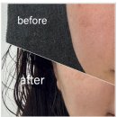 당곡1로2L | 환절기마다 터지는 건조한 피부, 이렇게 관리하세요 [보라매피부관리]