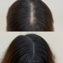 채움Beauty | 뒷가르마 만족 후 재방문, 이번엔 앞가르마 숱채움 SMP 후기 🤍 인천두피문신 송도두피문신 김포두피문신