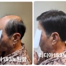 노원 혼주가발 추천!신랑 아버지의 당일맞춤가발 성공기 김호증모가발 리디아153노원점 후기