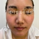 기가메디칼 이미지