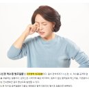 30~40대 여성 위협하는 시신경 척수염? 이미지